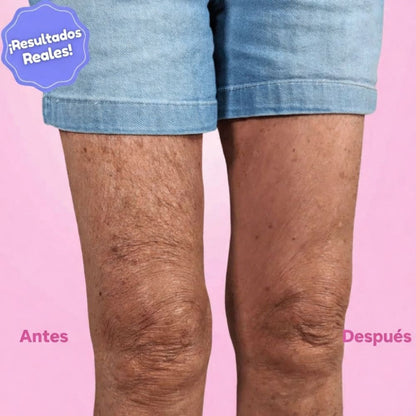 Tonificador Instantáneo Piernas y Glúteos
